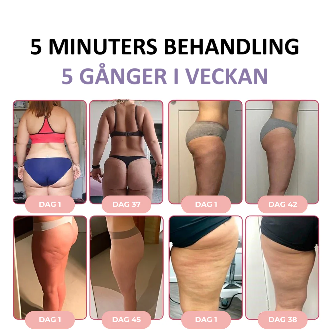 CellPro™ Fastare hud med djup massage