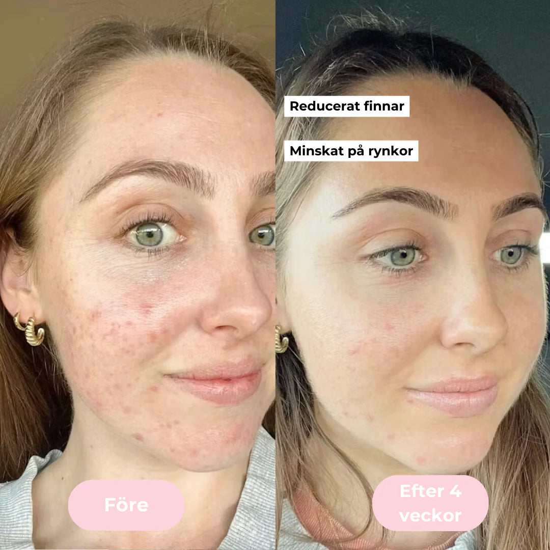 GlowUp™ Mikroström Ansikts- & Nackmassage – Reducera Rynkor & Strama Upp