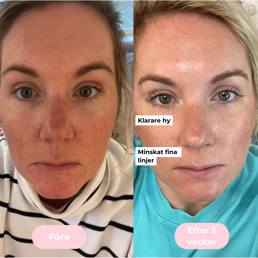 GlowUp™ Mikroström Ansikts- & Nackmassage – Reducera Rynkor & Strama Upp