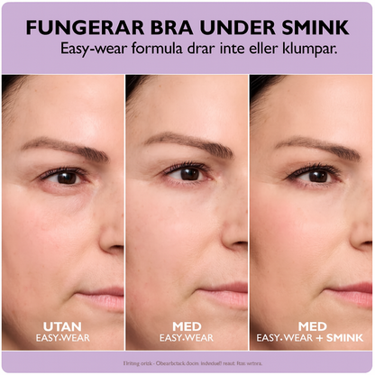 Softeland™ Slätare hud. Klarare blick. Självförtroende i varje ögonkast.