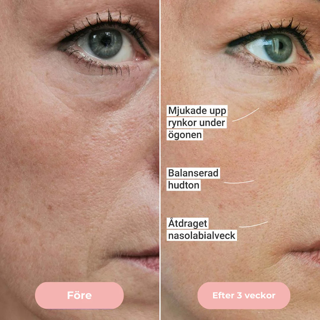 GlowUp™ Mikroström Ansikts- & Nackmassage – Reducera Rynkor & Strama Upp