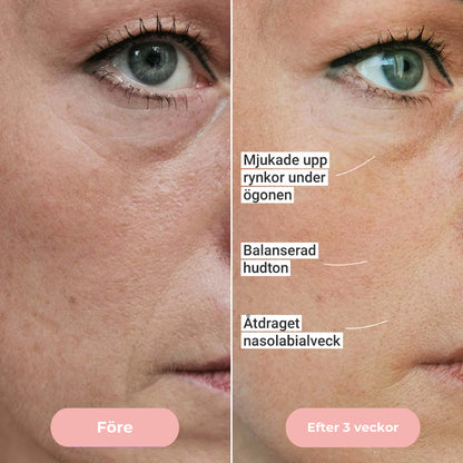 GlowUp™ Mikroström Ansikts- & Nackmassage – Reducera Rynkor & Strama Upp