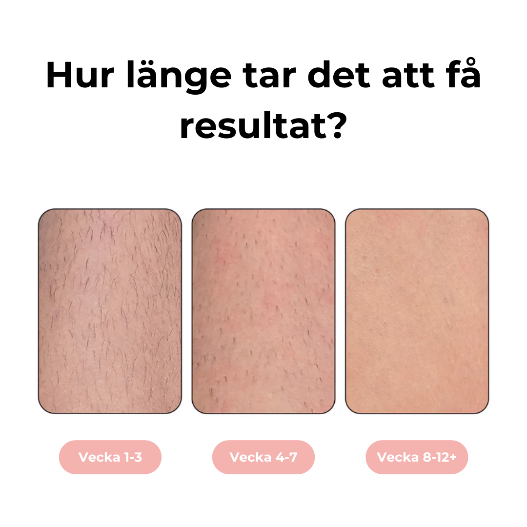 Tidslinje för när resultat märks vid IPL-behandling