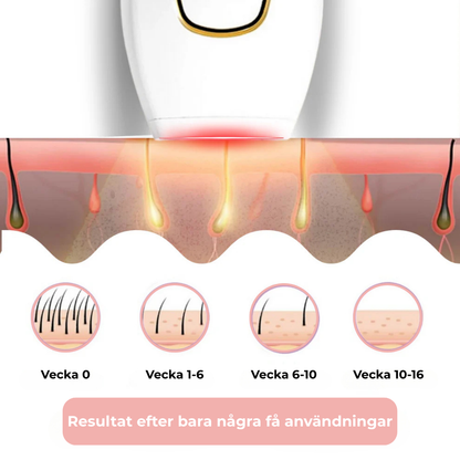 Illustration av hur IPL når hårsäcken
